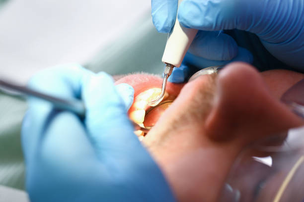 Best Emergency Tooth Extraction in Kittery Point, ME