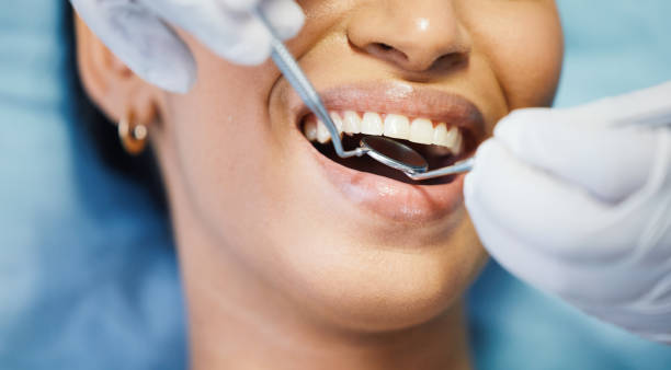 Best Emergency Treatment for Dental Infections or Abscesses in Kittery Point, ME